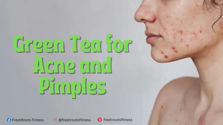 Green Tea for Acne and Pimples