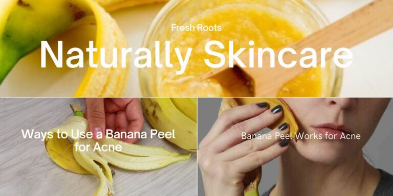 Banana Peel for Acne
