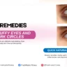 Home Remedies for Puffy Eyes