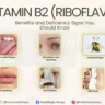 Vitamin B2