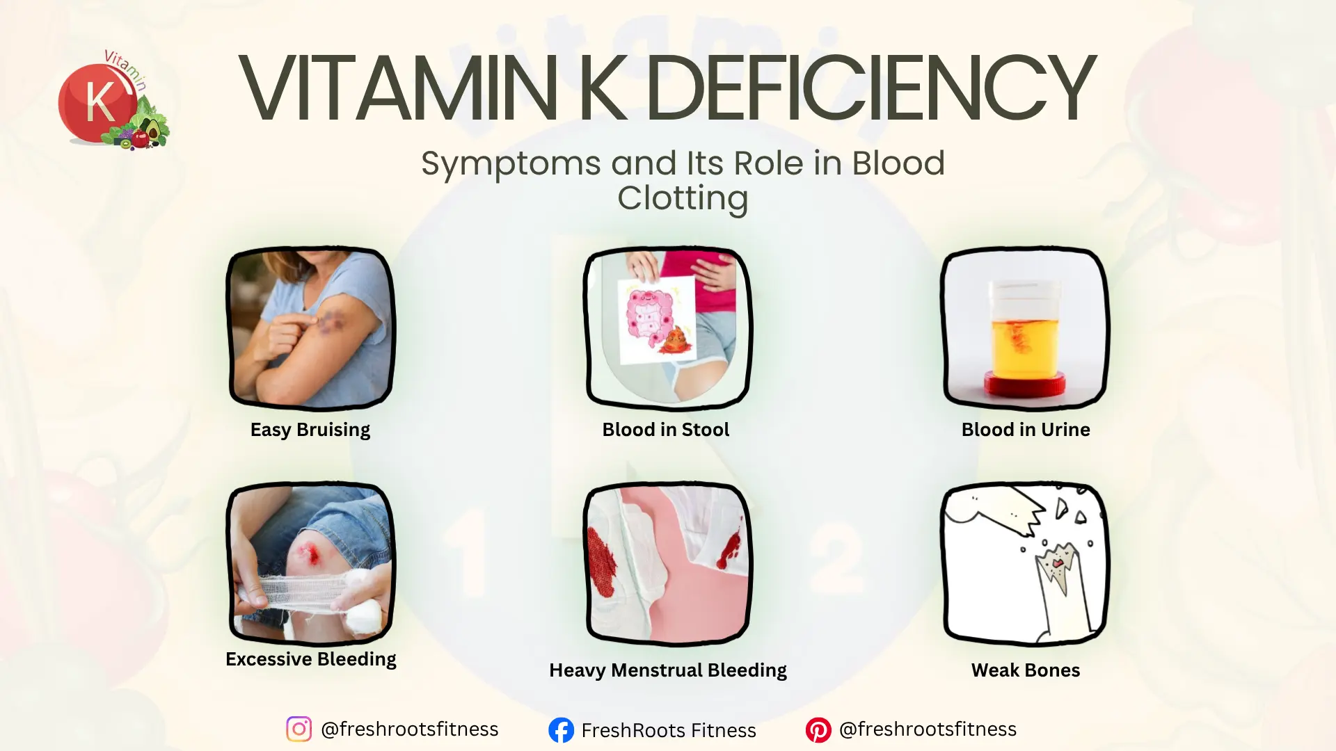 vitamin k deficiency symptoms