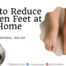 How to Reduce Swollen Feet at Home